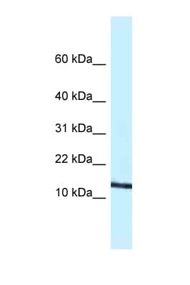 Polyclonal Rabbit anti-Mouse CCL11 / Eotaxin Antibody (C-Terminus, WB)