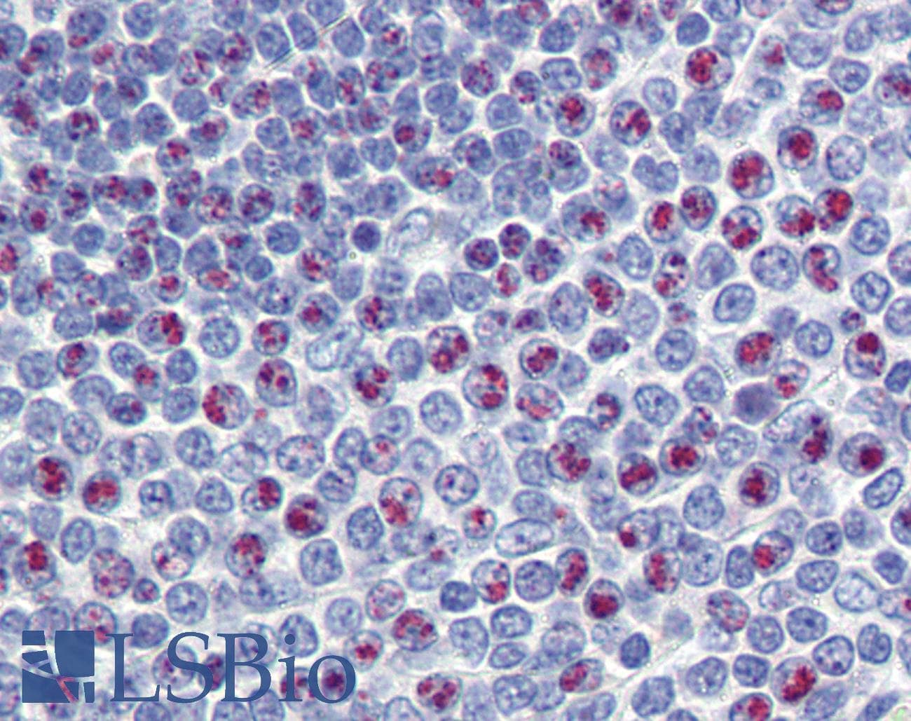 Polyclonal Rabbit anti-Human FOXM1 Antibody (C-Terminus, IHC, WB)
