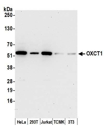 OXCT1 Antibody (aa470-520)