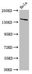 LAMC2 / Laminin Gamma 2 Antibody