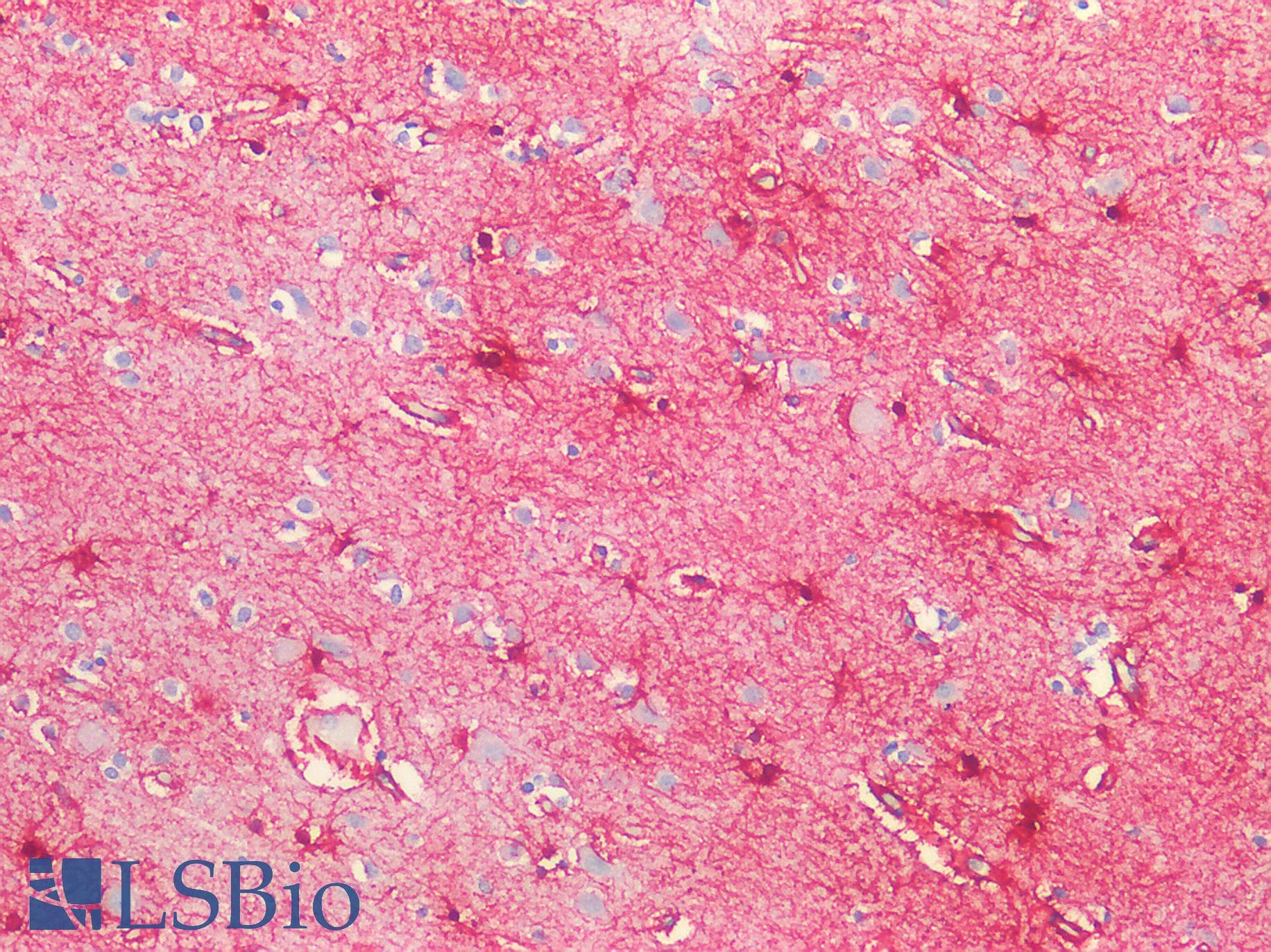 Polyclonal Rabbit anti-Mouse GFAP Antibody (aa253-354, IHC, WB)