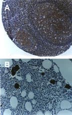 TRAF6 Antibody (aa451-469)