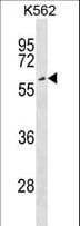 Polyclonal Rabbit anti-Human EYA2 Antibody (aa216-244, WB)