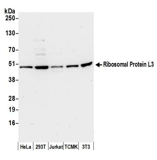 RPL3 / Ribosomal Protein L3 Antibody (aa325-375)