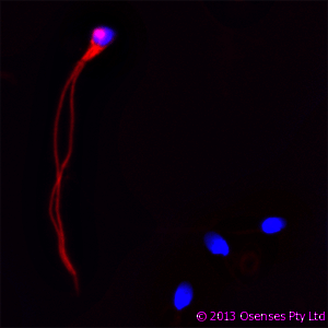 LL37 / Cathelicidin Antibody (clone OSX12)