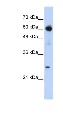 EBF / EBF1 Antibody (C-Terminus)