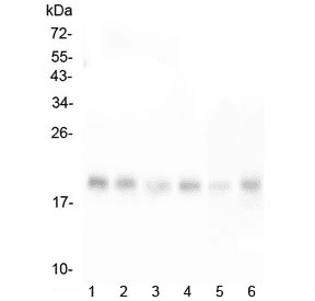 RMI2 / C16orf75 Antibody