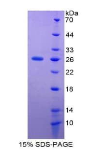 Human GH / Growth Hormone Protein (Recombinant His-T7)
