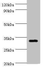 SLC25A15 / ORNT1 Antibody (aa1-301)