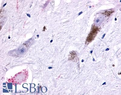 PathPlus™ Polyclonal Rabbit anti-Human GPR45 Antibody (Cytoplasmic Domain, IHC)