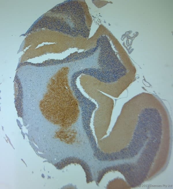 Polyclonal Rabbit anti-Human ACAN / Aggrecan Antibody (aa200-250, IHC)