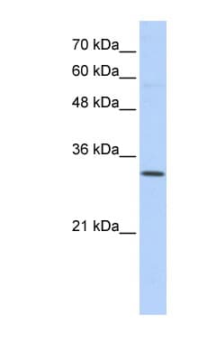 SFXN1 Antibody (N-Terminus)