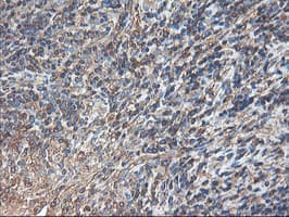 TUBAL3 Antibody (clone OTI1C2)