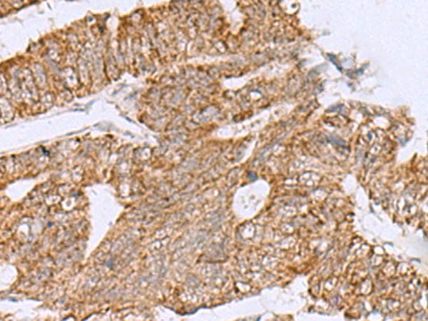 HCCS Antibody