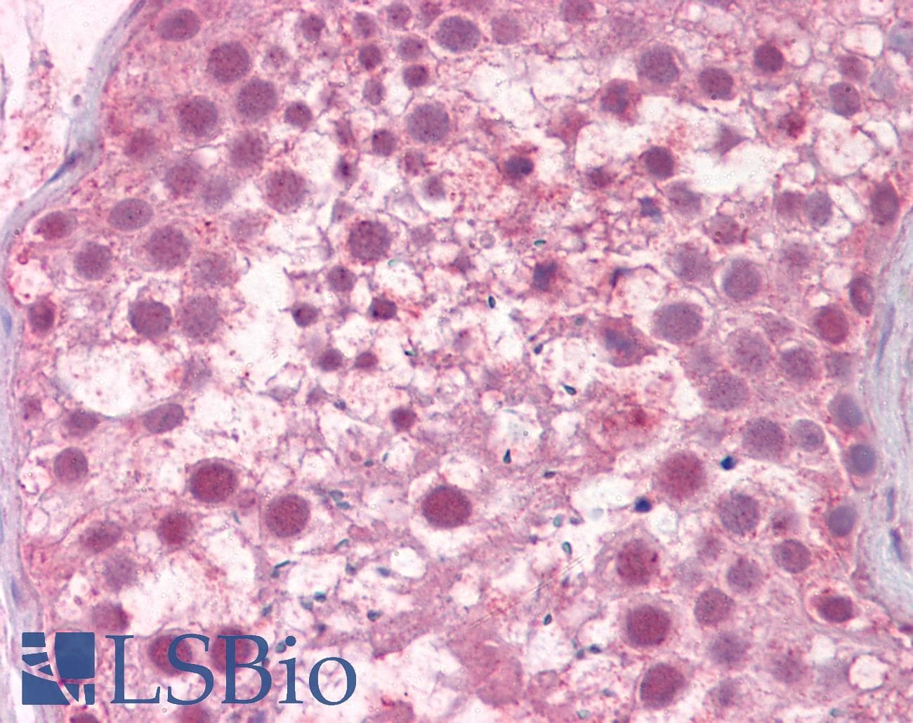 IHC-plus™ Polyclonal Rabbit anti-Human DICER1 / Dicer Antibody (aa1423-1440, IHC, WB)