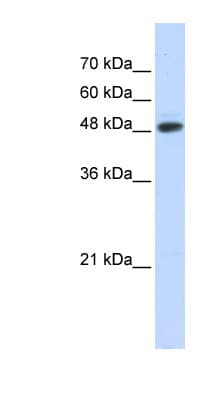 UBR7 / C14orf130 Antibody (N-Terminus)