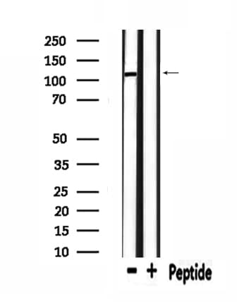 Polyclonal Rabbit anti-Human UBAP2L Antibody (IF, WB)