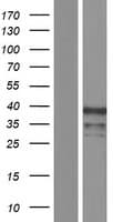 ZIC4 Protein (Over-Expression Lysate Myc-DDK (Flag))