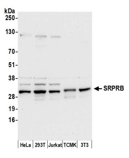 SRPRB Antibody (aa200-250)