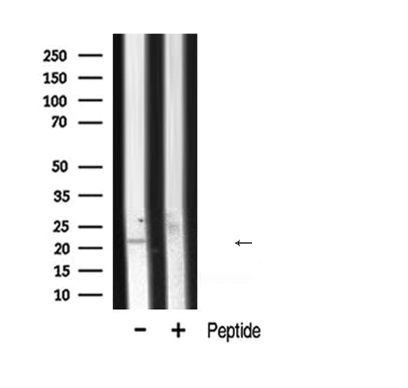 CLDN7 / Claudin 7 Antibody