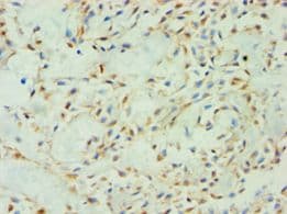 SPIN2B Antibody (aa1-258)