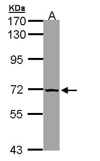 SLC25A13 / CITRIN Antibody (aa248-535)