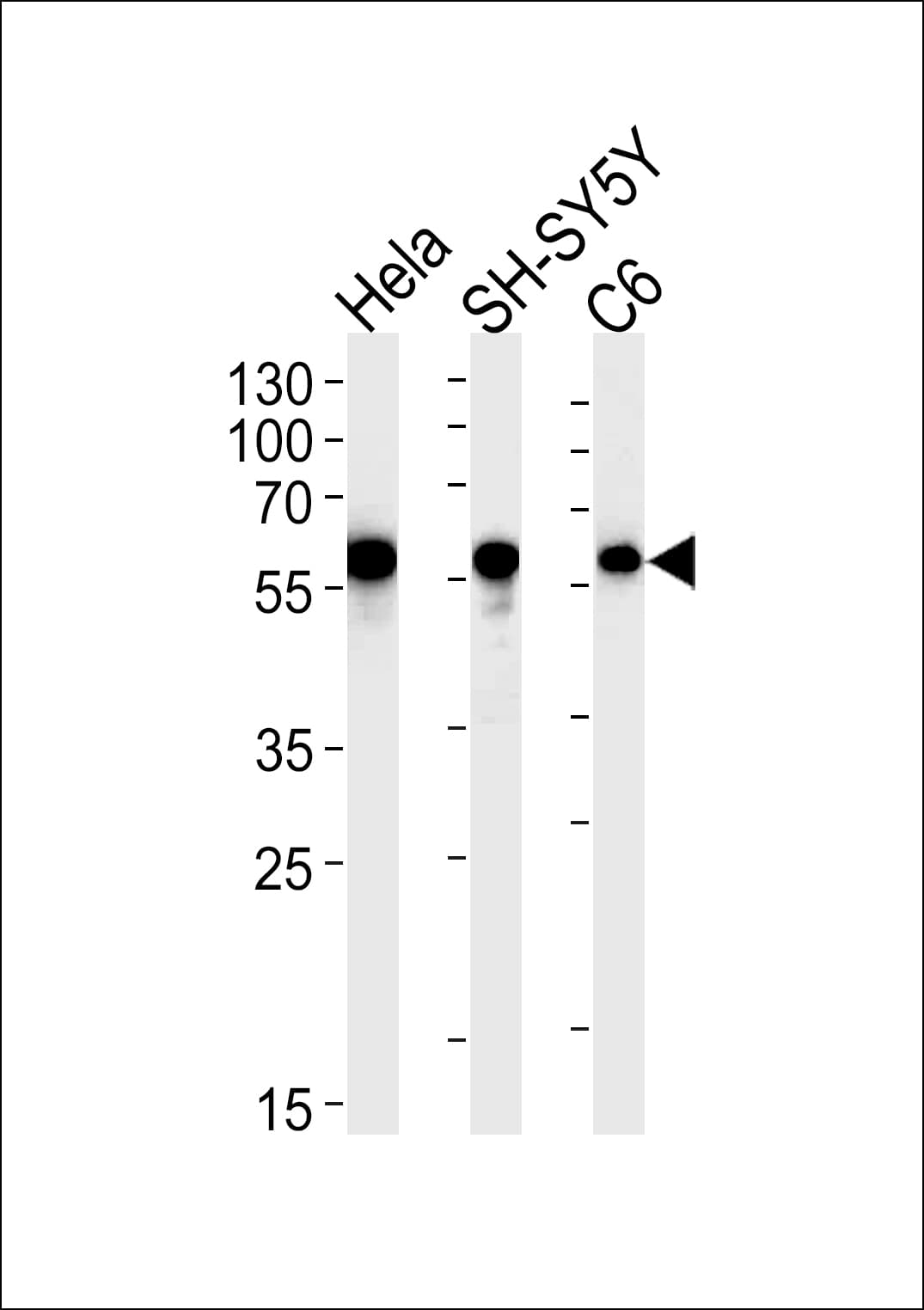 IHC-plus™ CALR / Calreticulin Antibody