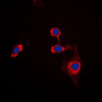 SIRPA / CD172a Antibody (C-Terminus)