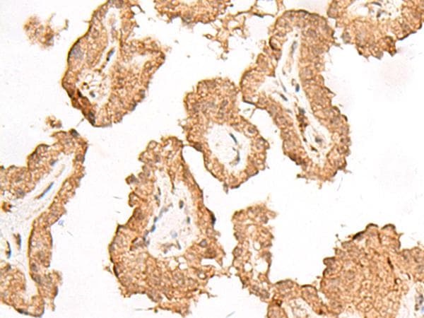 FGF13 Antibody