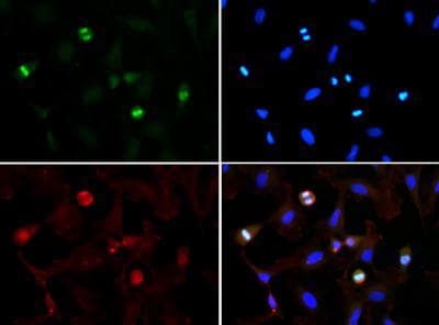 HIST3H3 Antibody (Me3-Lys56)
