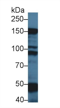 MYBPC1 Antibody (aa1-277, Cy3)