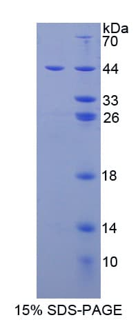Dog TSHB / TSH-Beta Protein (Recombinant His-GST-S)