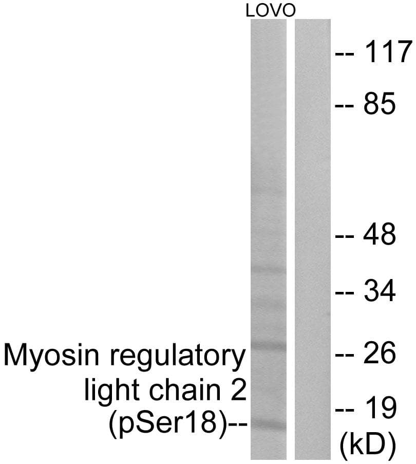 MYL12A / MRCL3 Antibody (phospho-Ser18)