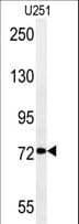 Polyclonal Rabbit anti-Human DEPDC1 Antibody (aa10-38, IHC, WB)