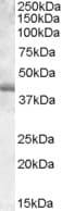 IHC-plus™ SPI1 / PU.1 Antibody (aa27-37)