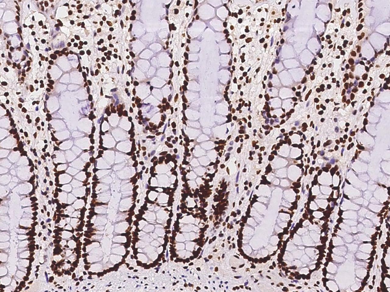 Polyclonal Rabbit anti-Human HNRNPC / HNRNP C Antibody (IHC, IF, WB)