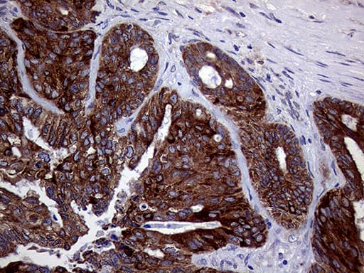 ASS1 / ASS Antibody (C-Terminus, clone OTI12G1)