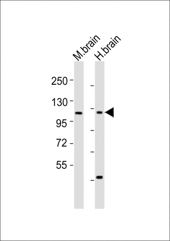 Polyclonal Rabbit anti-Human CHSY3 / CSS3 Antibody (aa295-329, WB)