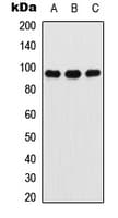 Polyclonal Rabbit anti-Human ATXN7 / SCA7 / Ataxin-7 Antibody (Internal, WB)