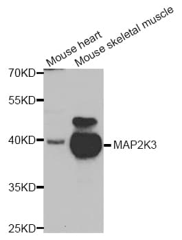 MAP2K3 / MEK3 / MKK3 Antibody (AP)