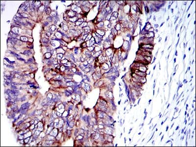 KRT19 / CK19 / Cytokeratin 19 Antibody (clone 400000000)