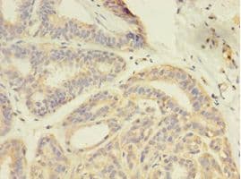GDI2 Antibody (aa1-445)