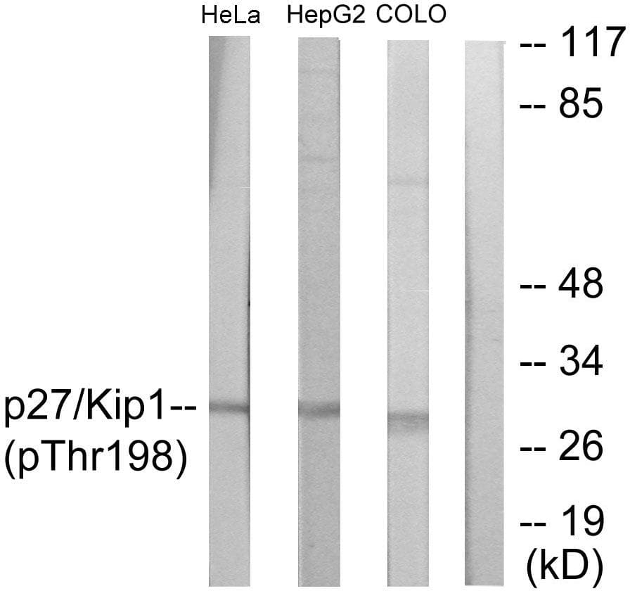 Polyclonal Rabbit anti-Human CDKN1B / p27 Kip1 Antibody (phospho-Thr198, WB)