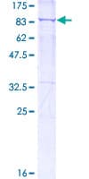 Human XRCC6 / Ku70 Protein (Recombinant GST)