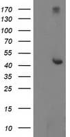 Monoclonal Mouse anti-Human AP50 / AP2M1 Antibody (clone OTI1F10, IF, WB)