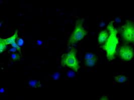 LTA4H / LTA4 Antibody (clone OTI7D11)