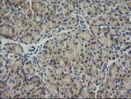 HRAS / H-Ras Antibody (clone OTI1D9)