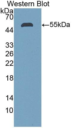 STC1 / Stanniocalcin Antibody (aa28-247)