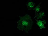 Monoclonal Mouse anti-Human CTNNB1 / Beta Catenin Antibody (clone OTI8B5, IF, WB)