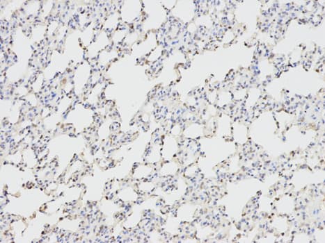 ANGPTL4 Antibody